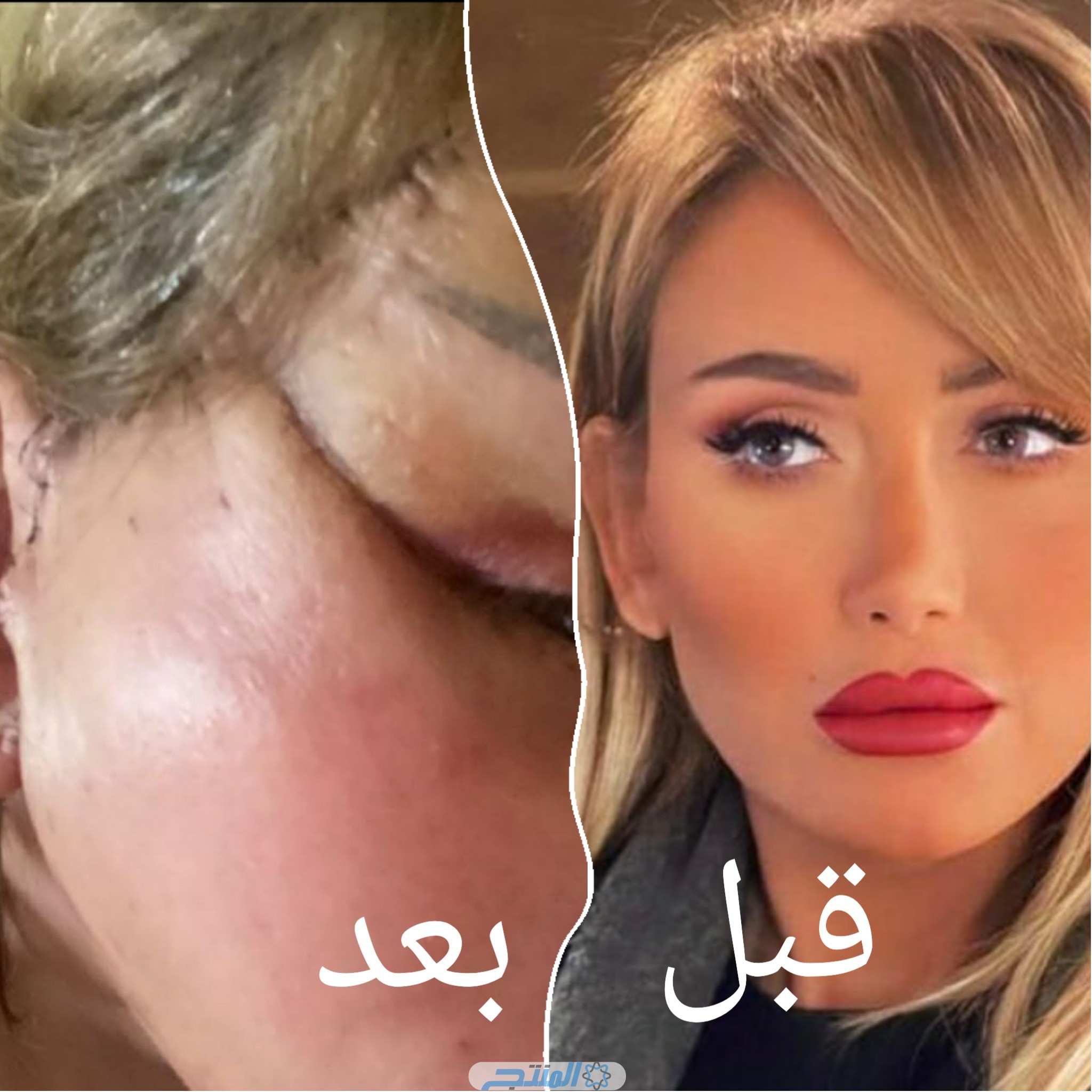 ريهام سعيد قبل وبعد التجميل